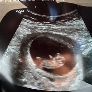 Meet your Posher, Dulce